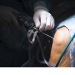 Artroscopia de genunchi – cum trebuie să te pregătești de această intervenție?