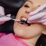 Descoperă soluții de înfrumusețare dentară în Iași: Fatete dentare și coroane dentare