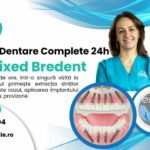 Implant dentar rapid Fast & Fixed: Soluția modernă pentru pacienții edentați