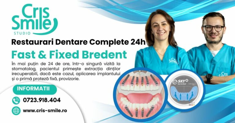 Implant dentar rapid Fast & Fixed: Soluția modernă pentru pacienții edentați