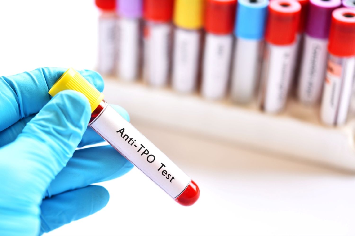 Ce înseamnă testul anti TPO și cum te poate ajuta în diagnosticarea problemelor tiroidiene